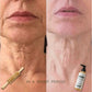 Vorys Collagen Oil | Absorbs Instantly. Increases Skin Firmness.